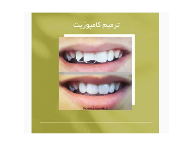 جراحی دندان در شیراز- جراح و دندانپزشک زیبایی در شیراز